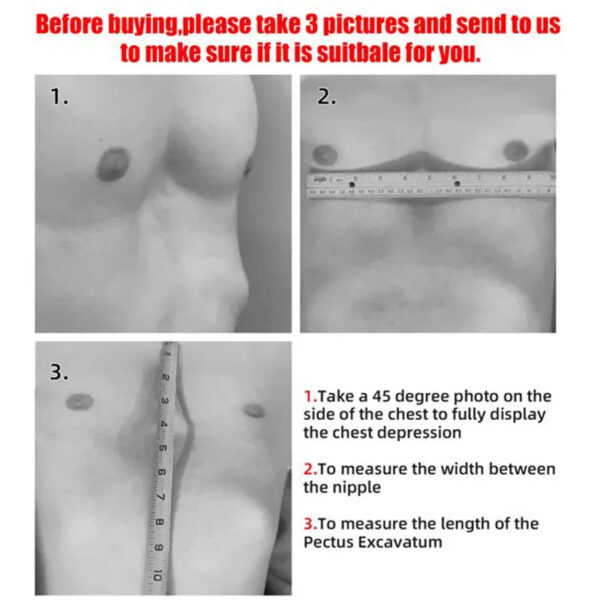 Pectus Excavatum Brace Pectus Excavatum Vacuum Bell Pectus Excavatum Orthosis Sternum Brace Chest Brace for Pectus Excavatum for - Image 3